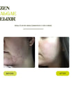 THE SKIN BALANCE DUO
