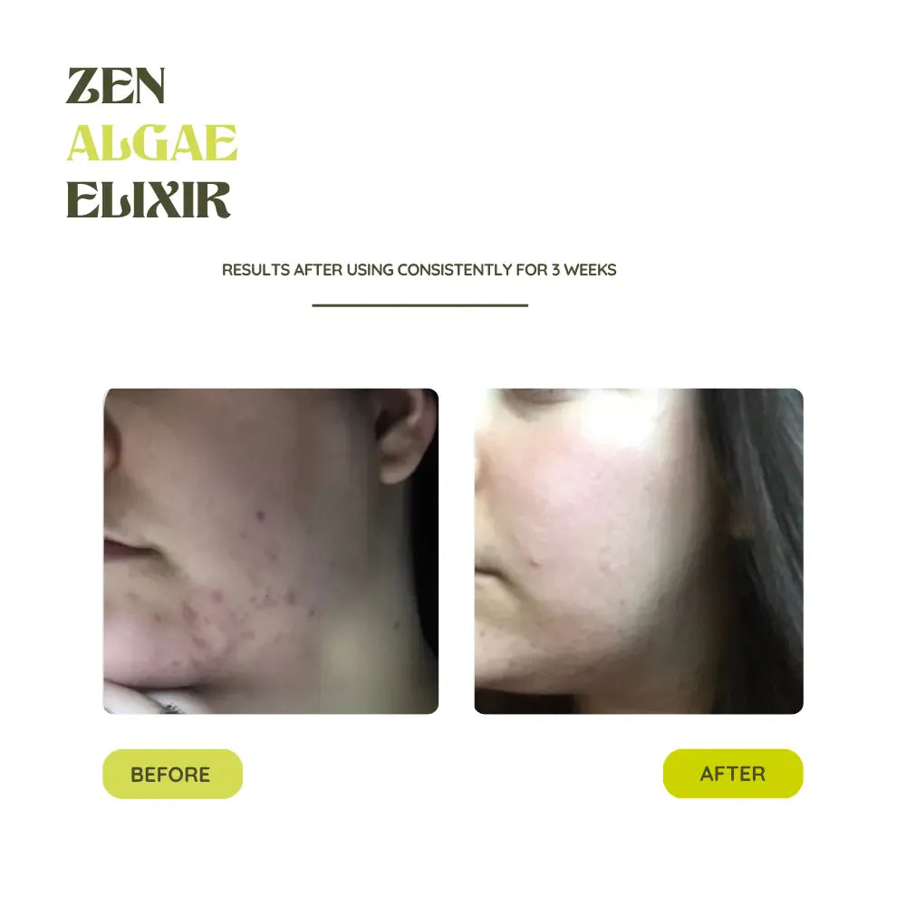THE SKIN BALANCE DUO